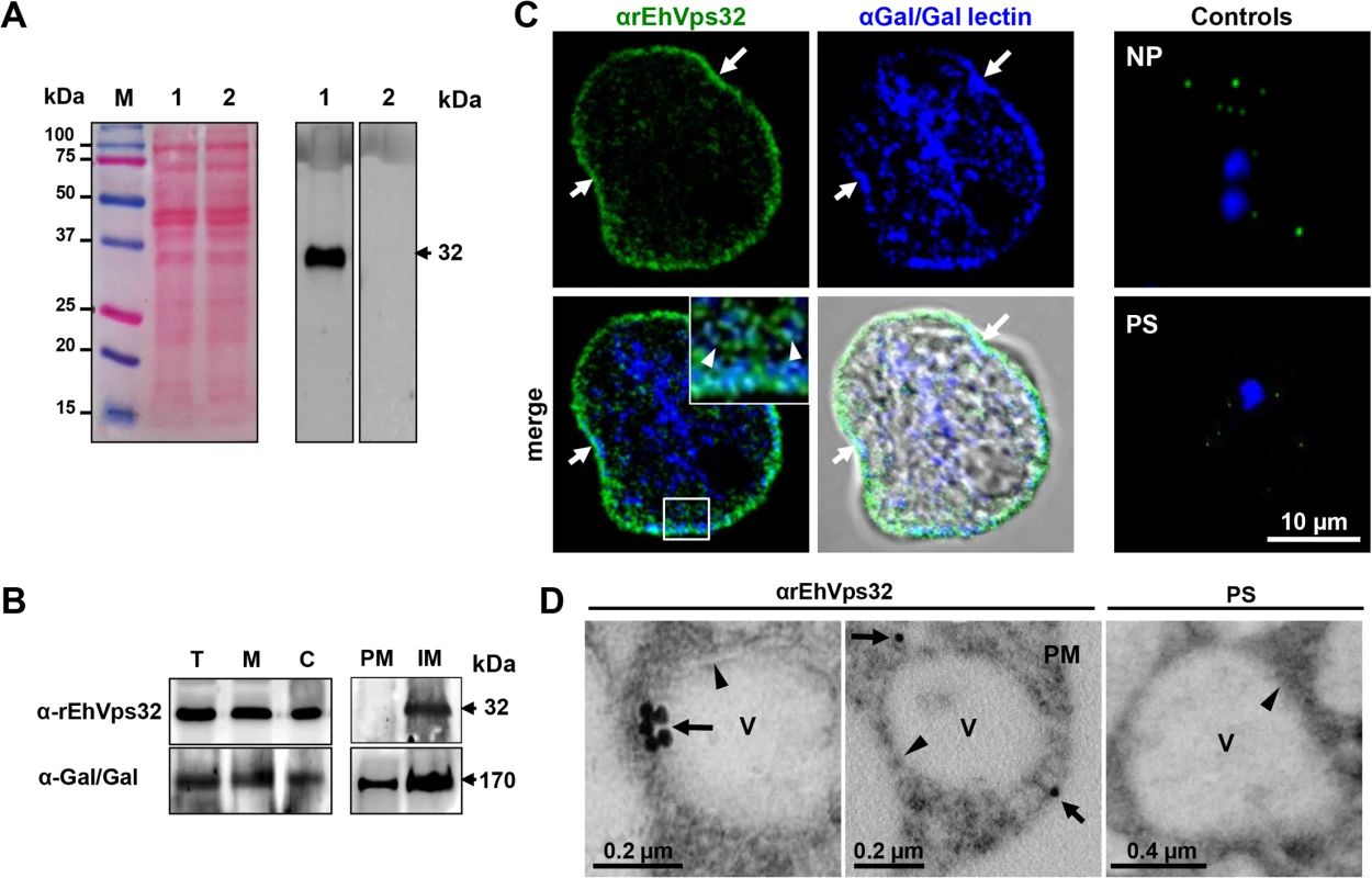 Detection and localization of EhVps32 protein in trophozoites lysates and fixed trophozoites.