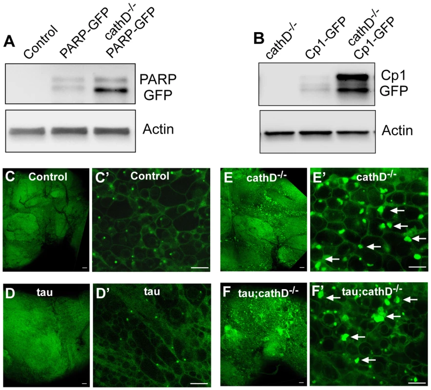 Widespread lysosomal abnormalities in cathepsin D deficient brains.