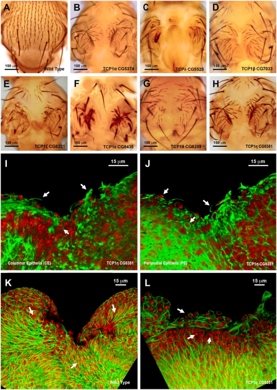 Thorax fusion and impaired healing phenotypes of TCP1 subunits.