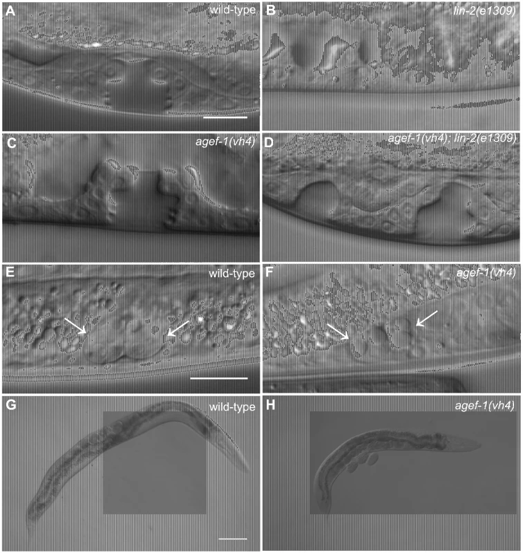 <i>agef-1(vh4</i>) suppresses the <i>lin-2(e1309)</i> Vul phenotype, has large vesicles in coelomocytes and a dumpy body morphology.