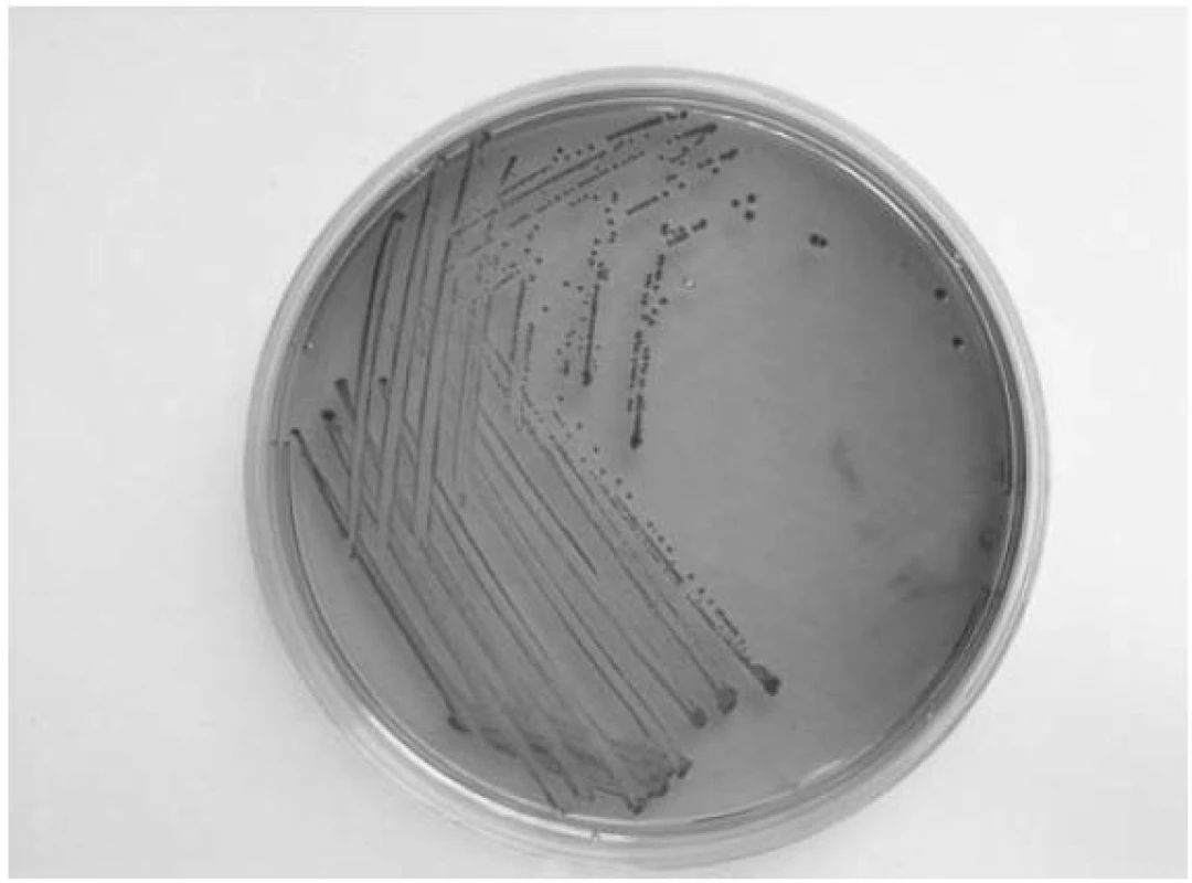 Kmen <em>E. coli</em> z laboratorní sbírky NRL pro <em>E. coli</em> a shigely (SZÚ-CEM)