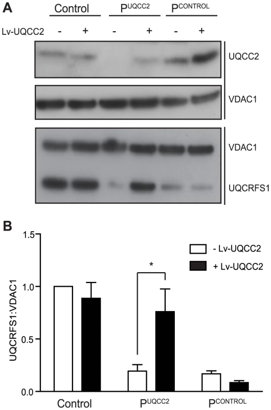 <i>UQCC2</i> mutations are responsible for the complex III defect in P<sup>UQCC2</sup>.