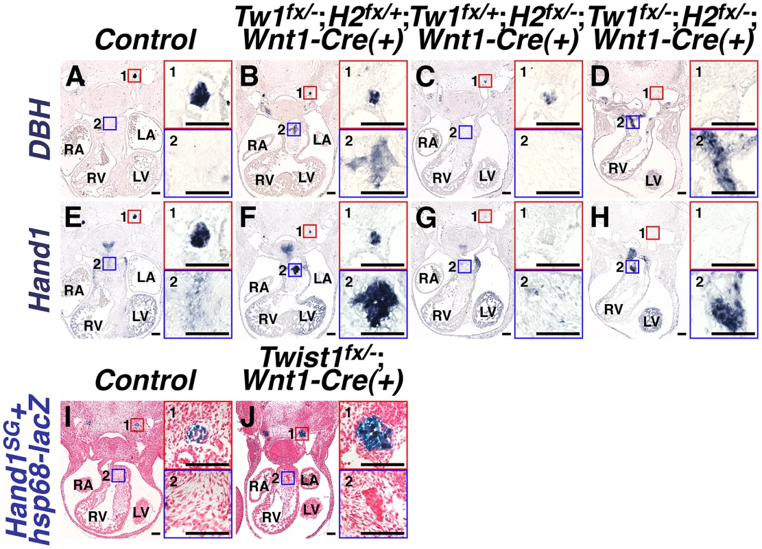 Ectopic sympathetic-like neurons in <i>Twist1</i>;<i>Wnt1-Cre</i> CKO APCs are not <i>bona fide</i> sympathetic neurons.