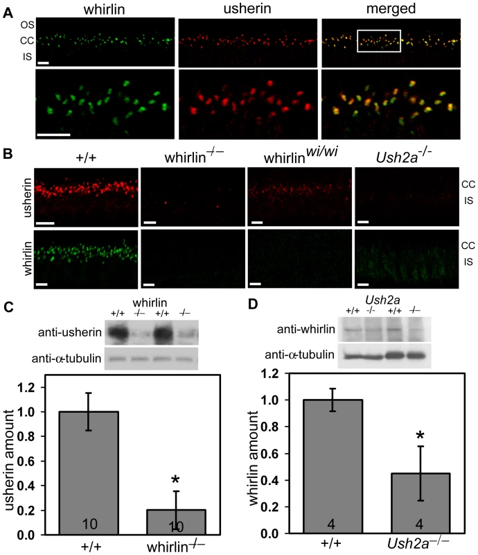 Whirlin and usherin are colocalized in photoreceptors.