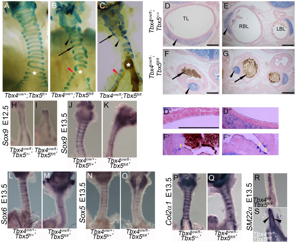 Loss of <i>Tbx4</i> and <i>Tbx5</i> disrupts tracheal/bronchial cartilage and smooth muscle formation.