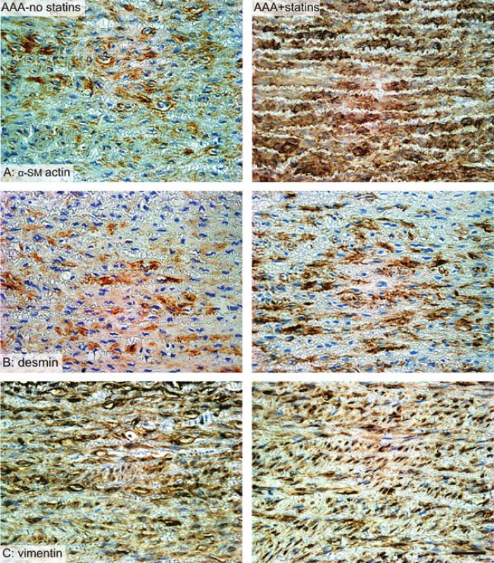 Srovnání imunohistochemických preparátů
Fig. 2: Immunohistochemistry – comparison of sections