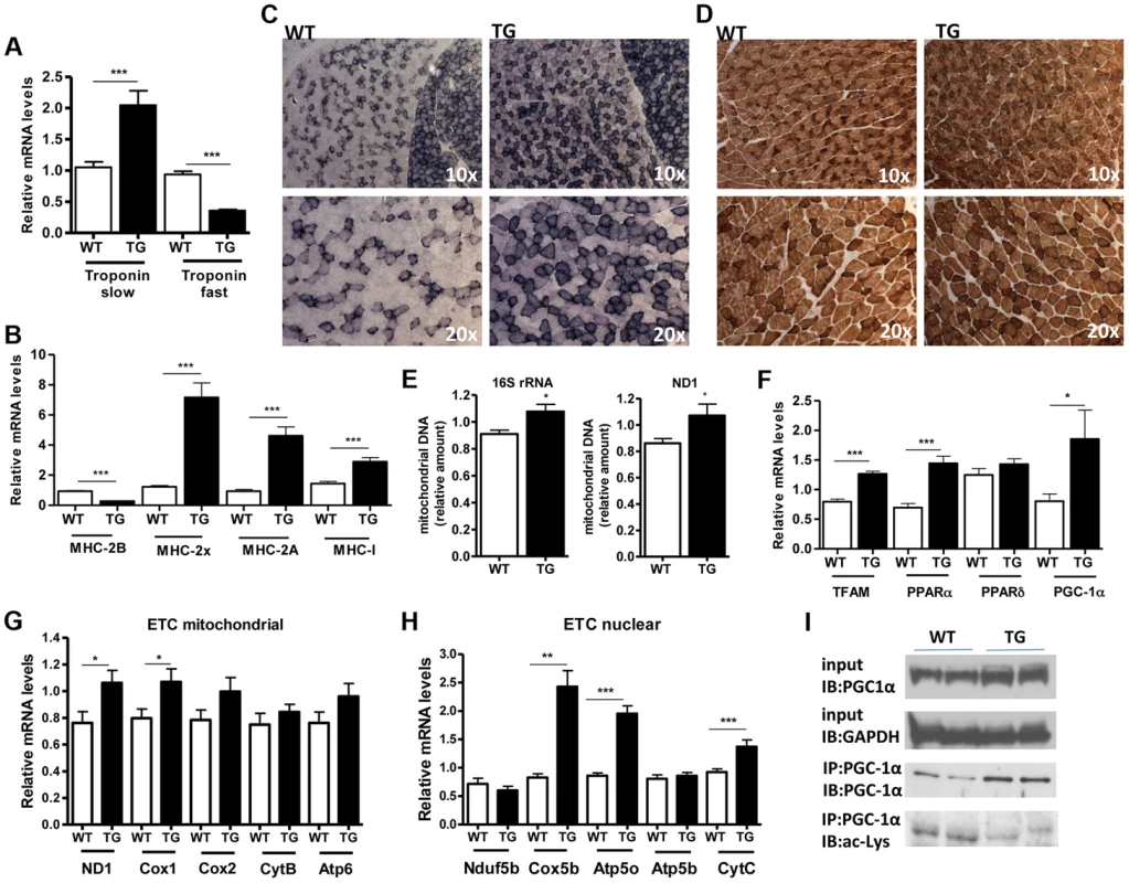 SIRT1 overexpression drives fast-to-slow fiber type switch.
