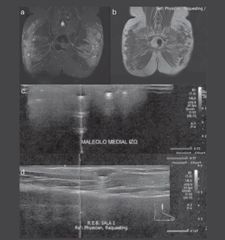 MRI of the pelvis and ultrasound of the ankle.