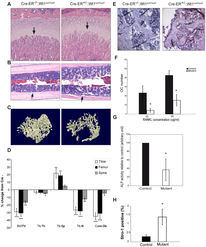 Deletion of <i>Wt1</i> leads to rapid bone loss.