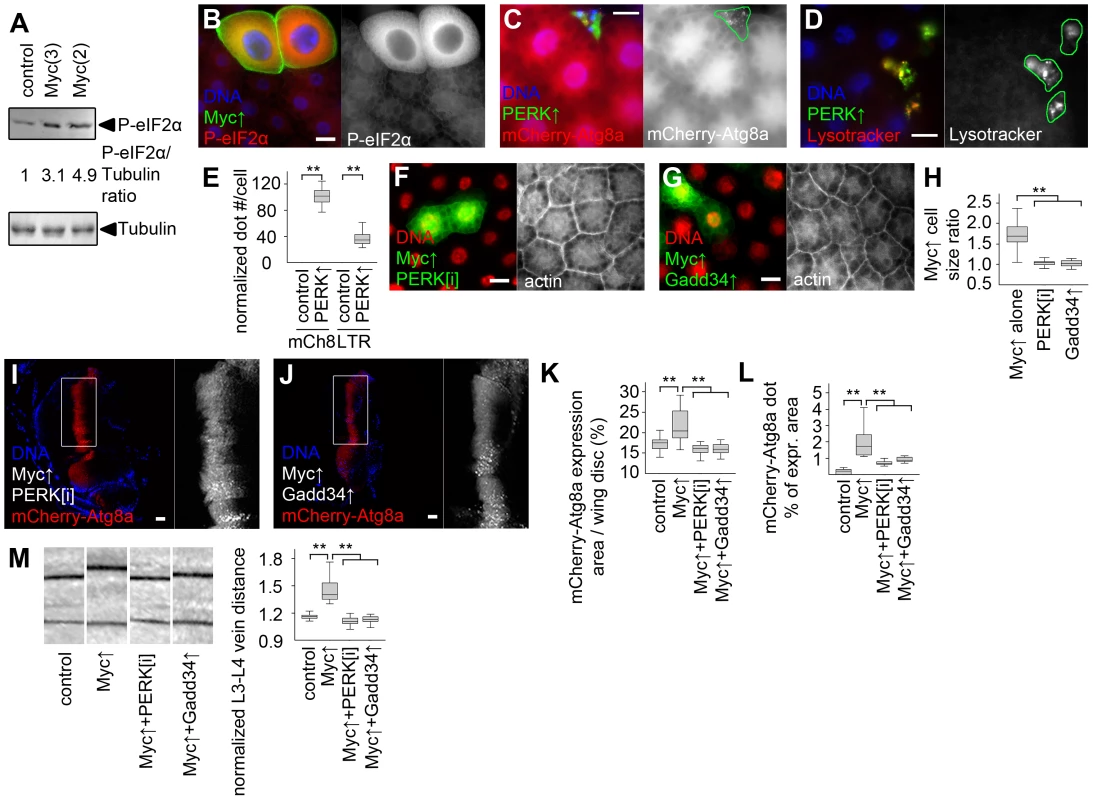 Myc-induced UPR is required for increased cell growth and autophagy.