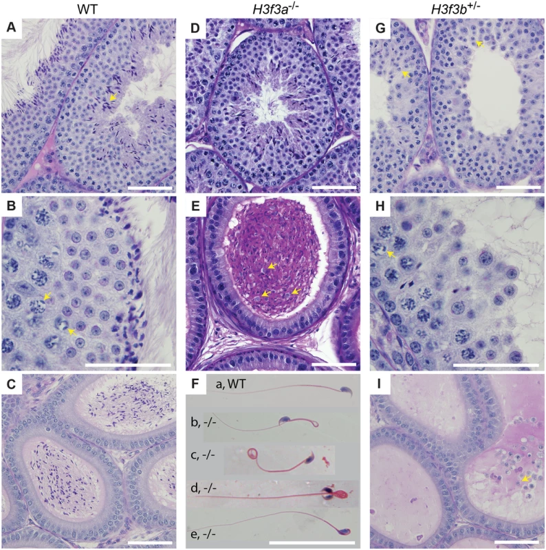 Testis and sperm morphology.