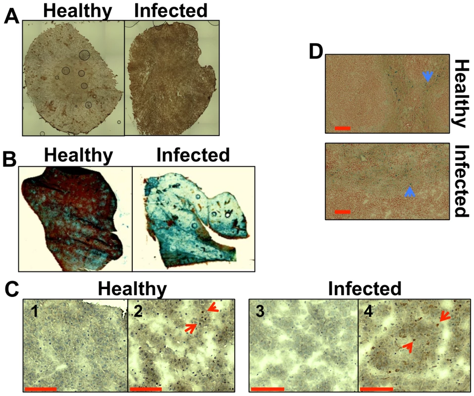 Systemic candidiasis affects host iron homeostasis. A.