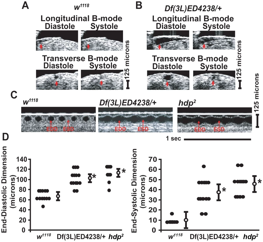 Identification of a genomic deletion mutant that has an enlarged cardiac chamber.