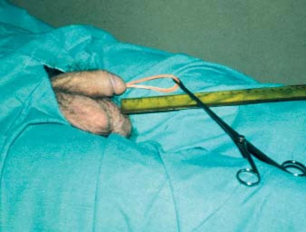Zavařovací guma „masovka“.