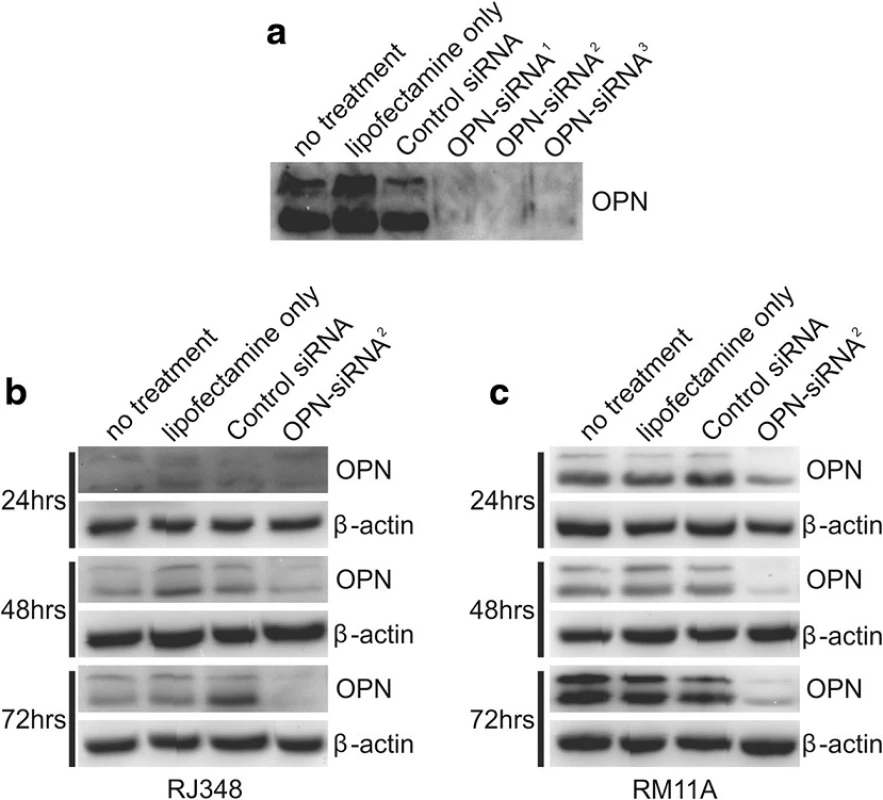 Representative western blots showing OPN protein levels in (a) RM11A cell following no treatment, treatment with lipofectamine only, treatment with a GC control siRNA or 3 different siRNAs targeting different regions on OPN mRNA. Representative western blots of OPN protein level following no treatment, treatment with lipofectamine only, treatment with a GC control siRNA or treatment with OPN- siRNA<sup>2</sup> in (b) RJ348 cells and (c) RM11A cells 24, 48 or 72 h after transfection
