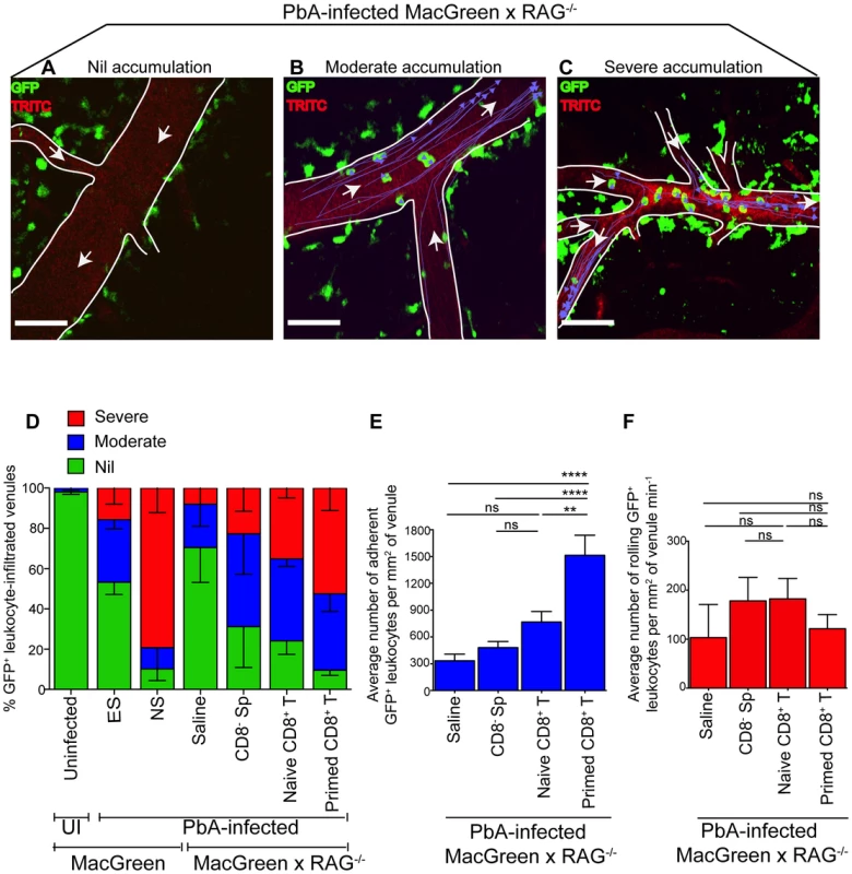 <i>Plasmodium</i>-primed CD8<sup>+</sup> T cells induce monocyte accumulation in MacGreen×RAG<sup>−/−</sup> mice.
