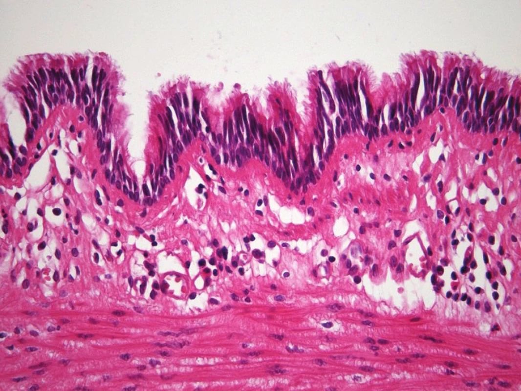 Histologie, H-E barvení, bronchiální epitel
Fig. 6: Histology, H-E staining showing bronchial epithelium