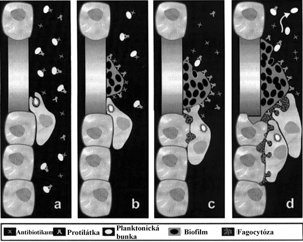 Zobrazenie medicínsky významnej tvorby biofilmu a jej
úlohy v ochrane kvasiniek pred: (a, b) antimykotikami a protilátkami,
(c, d) fagocytózou. Upravené podľa:
(<a href="http://www.geocities.com/cesarcaro314/papers/Image9.jpg">http://www.geocities.com/cesarcaro314/papers/Image9.jpg</a>).
Fig. 1. Representation of medically relevant biofilm formation
and of its role in the protection of yeasts from: (a, b) antifungals
and antibodies and (c, d) phagocytosis. Adapted from:
(<a href="http://www.geocities.com/cesarcaro314/papers/Image9.jpg">http://www.geocities.com/cesarcaro314/papers/Image9.jpg</a>).