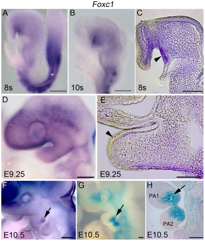 Dynamic expression of <i>Foxc1</i> in PA1.