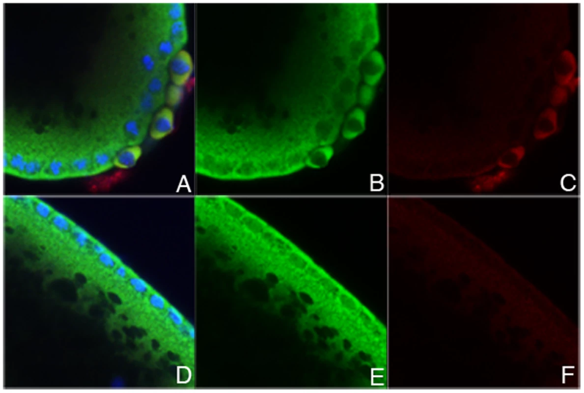 Some eIF4E protein is located in the nucleus.