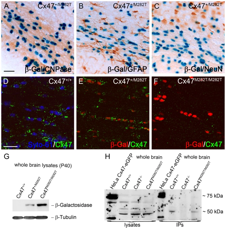 mCx47<i>M282T</i> and β-gal expression in oligodendrocytes of 40-day-old mutant mice.