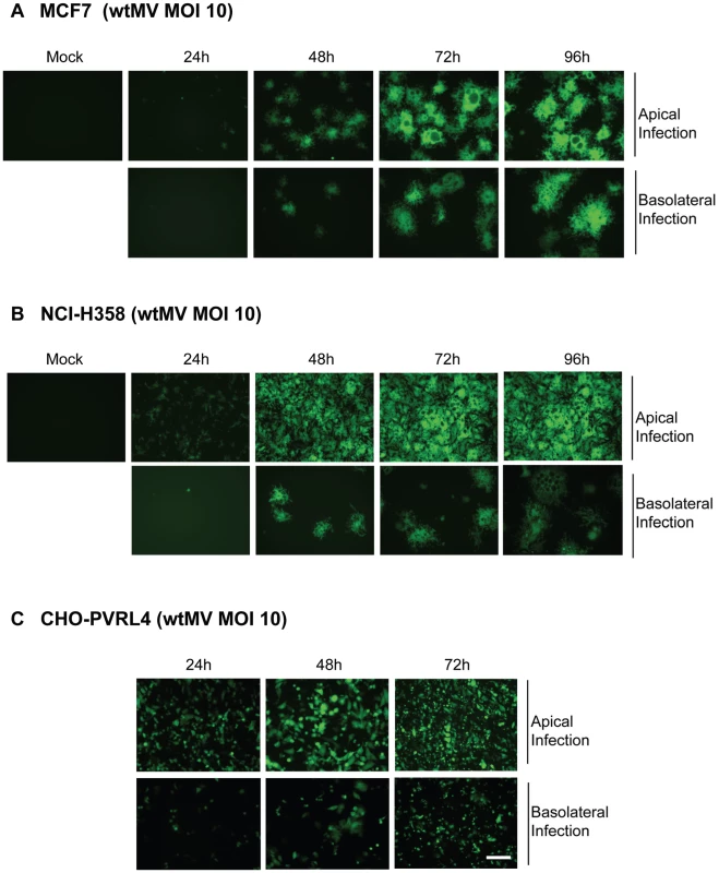 MV infects polarized adenocarinoma cells via either the apical or basolateral surfaces.
