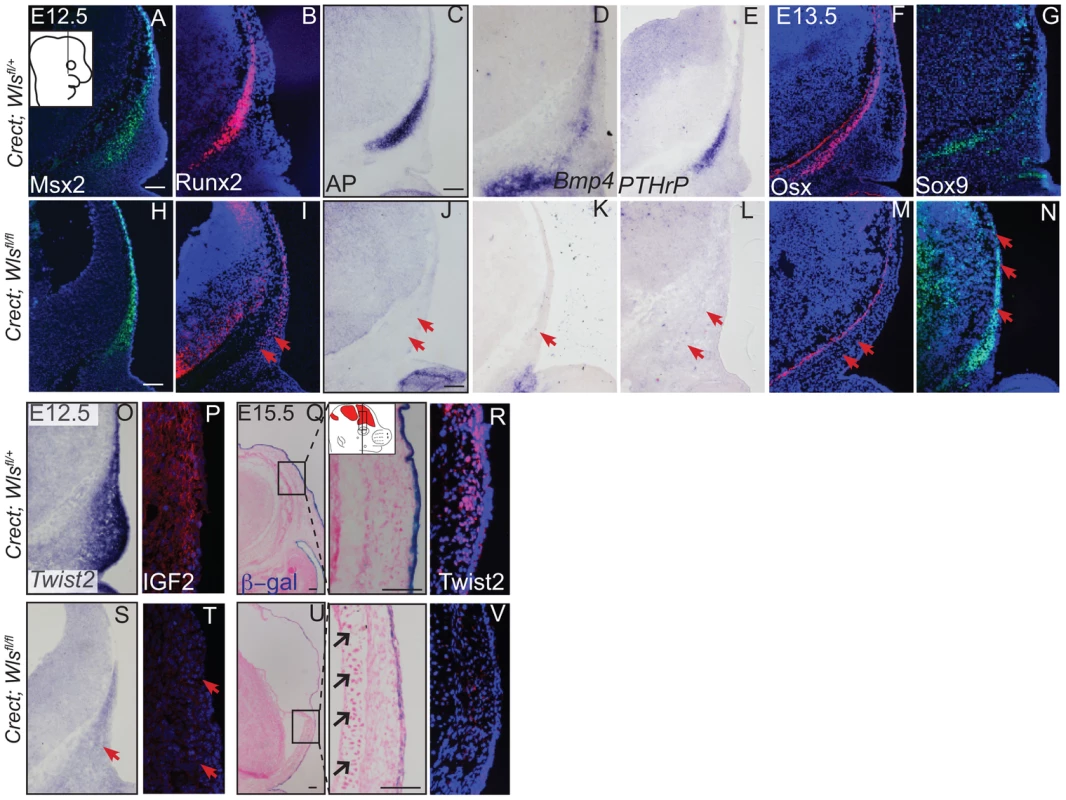 Ectoderm deletion of <i>Wntless</i> leads to loss of cranial bone and dermal lineage markers in the mesenchyme.