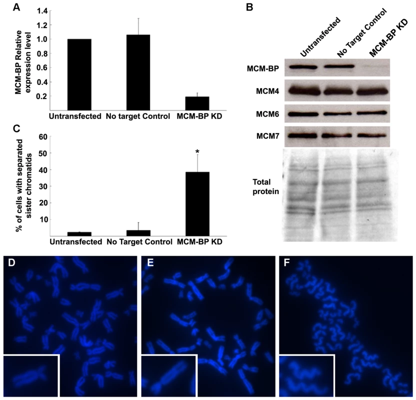Induction of cohesion defects by downregulation of human <i>MCM-BP</i>.
