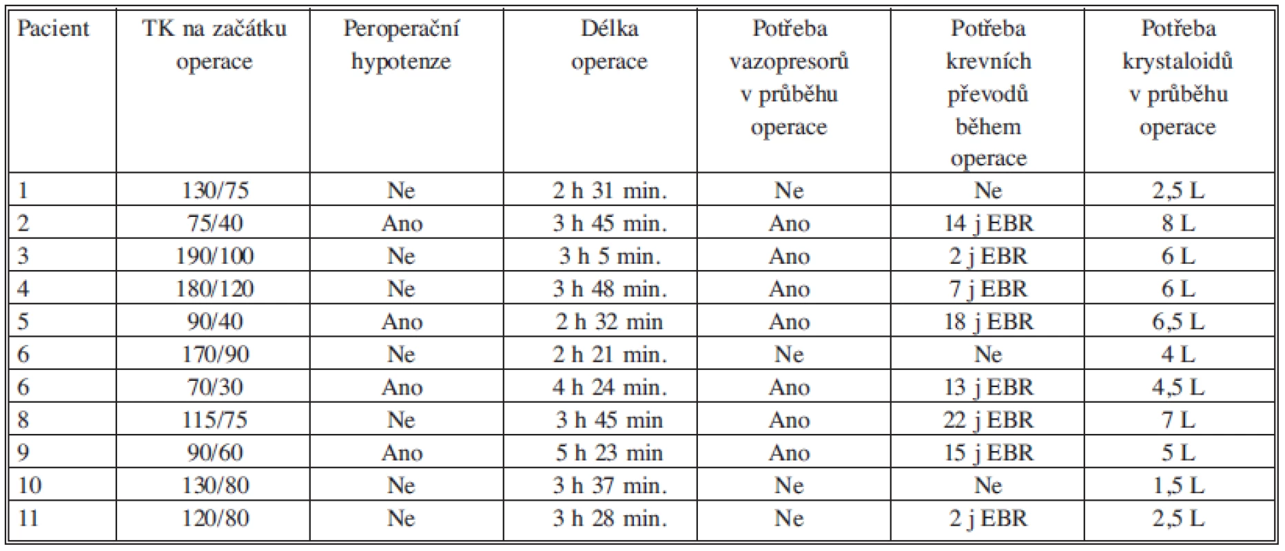 Zhodnocení peroperačních rizikových faktorů pro vznik ischemické kolitidy
Tab. 2. Intraoperative risk factors influencing the development of ischemic colitis.
