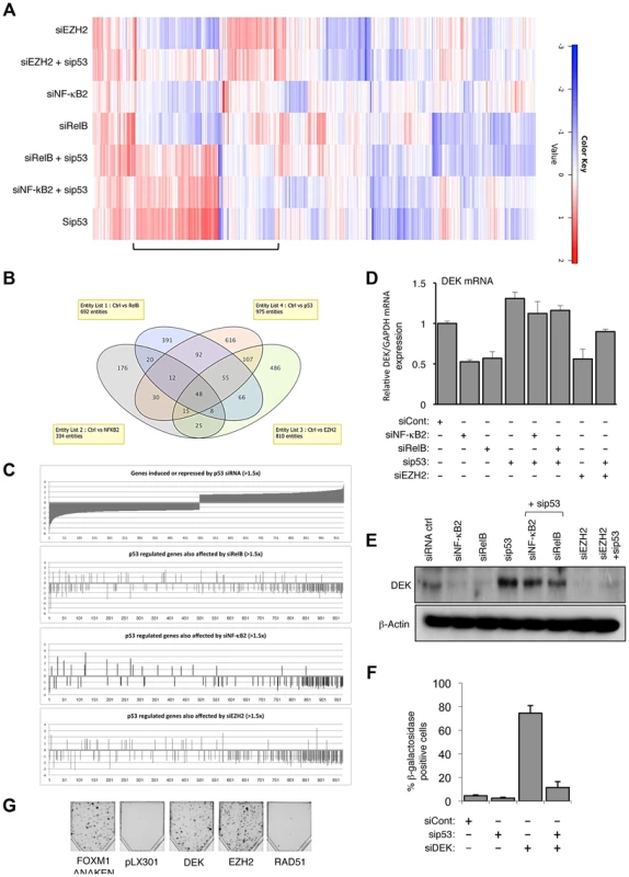 EZH2 is a critical effector of an antagonistic cross-talk between NF-κB and p53.