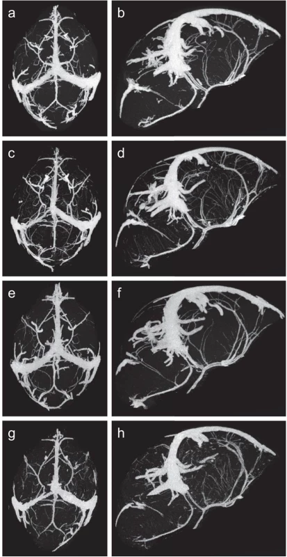 Micro-CT images of fetal cerebral vasculature at gestational day 18.