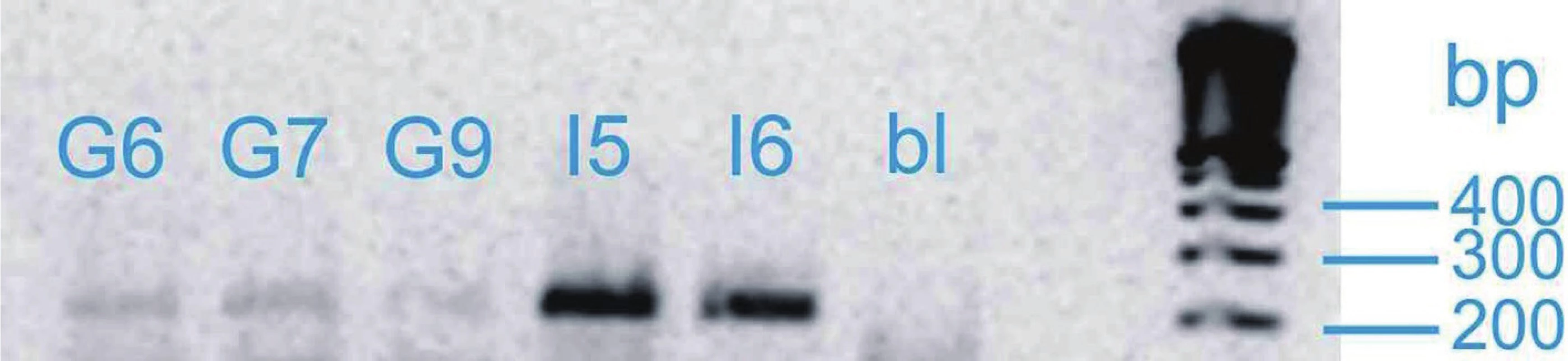 Vizualizace genu SHB
Fig. 1. Visualization of SHB gene