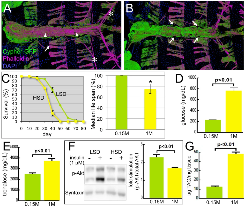 <i>Drosophila</i> model of diabetic cardiomyopathy.