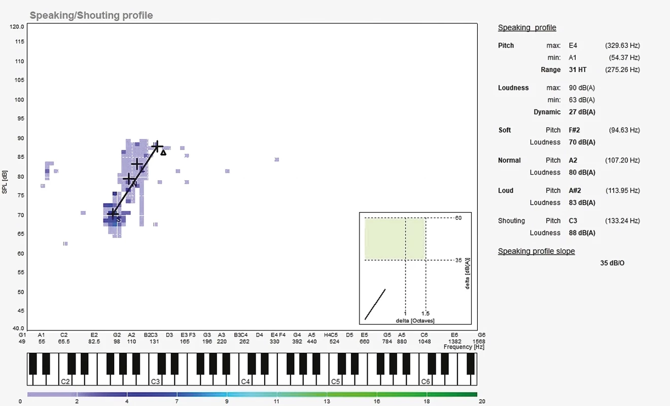 Hlasová analýza 2 měsíce po operaci. // Fig. 1. Voice analysis 2 months after surgery.