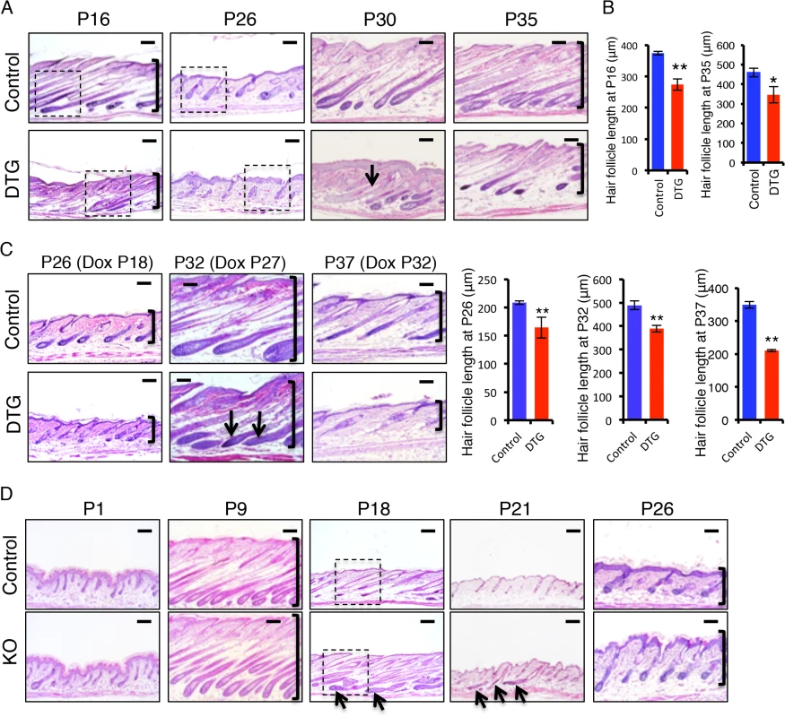 <i>miR-22</i> promotes the transition from anagen to catagen and retards the transition from telogen to anagen.