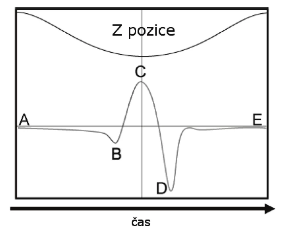 Průběh jednoho cyklu při Peak Force Tapping. V horní části pohyb vůči ose Z, ve spodní části silové působení v závislosti na čase. Upraveno z [24].