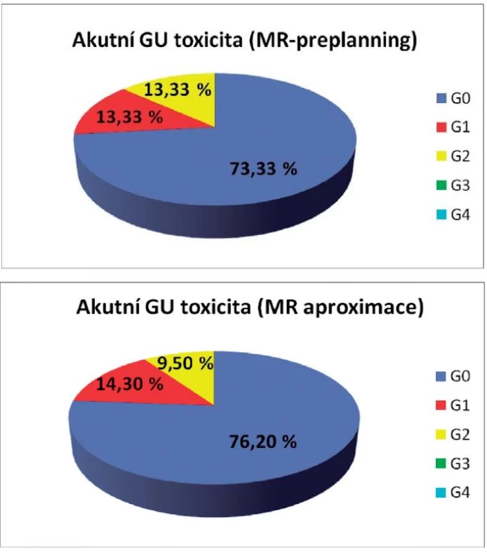 Akutní genitourinární toxicita