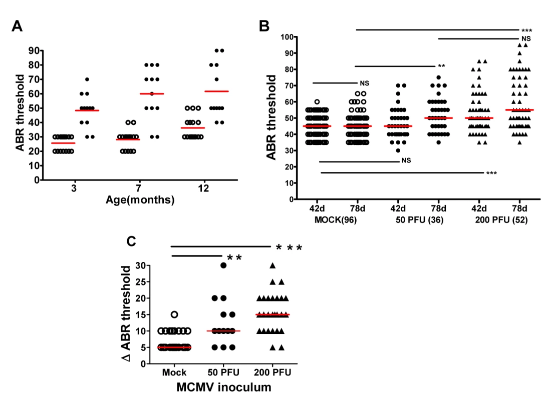 Progressive hearing loss and virus inoculum effect on progression of hearing loss in MCMV infected mice.