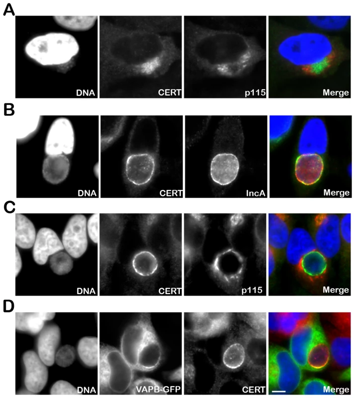 CERT and VAPB localize to <i>C. trachomatis</i> inclusion.