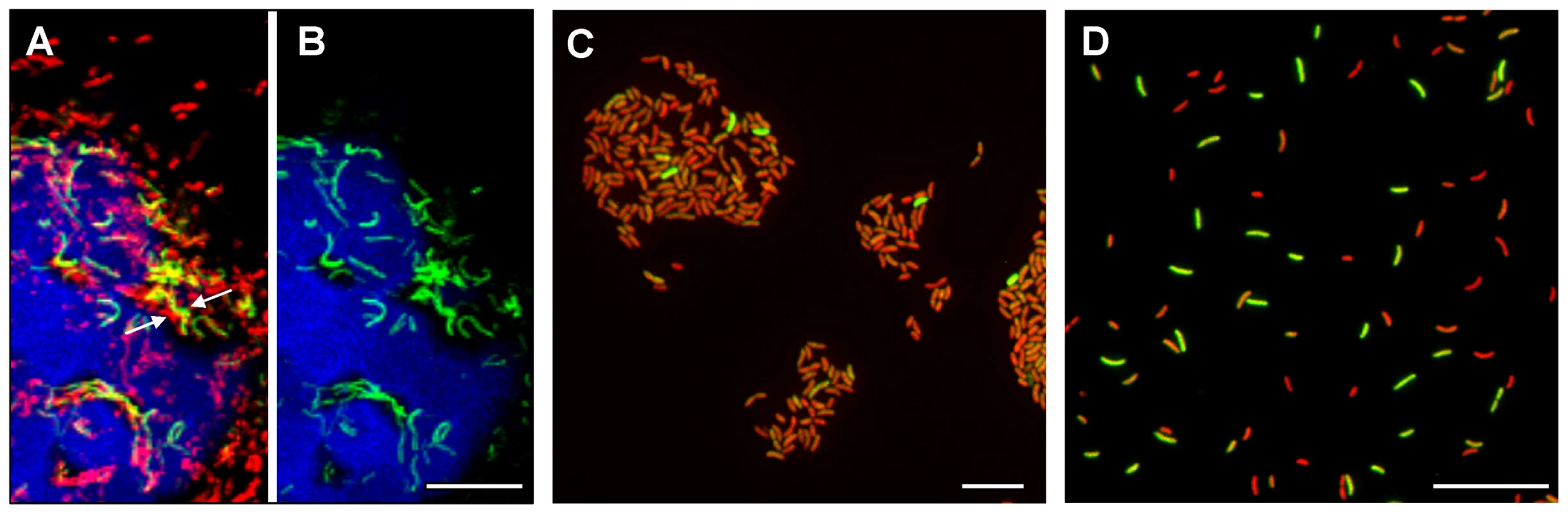 Heterogeneous expression of <i>tcpA-gfp(ASV)</i> in rabbit ileal loops and during in vitro conditions of growth that induce the expression of <i>V. cholerae</i> virulence genes.