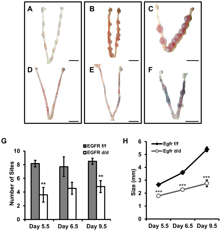 <i>Egfr</i> ablation causes blastocyst implantation site demise.