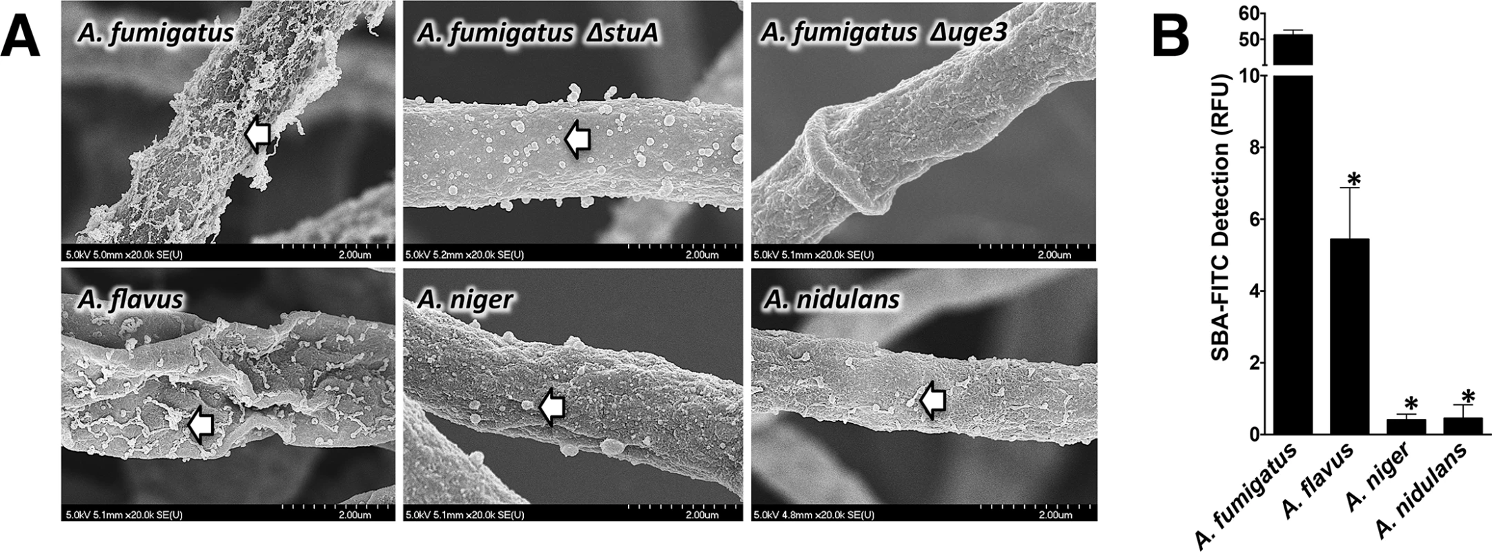 Production of GalNAc-rich GAG correlates with reported virulence of <i>Aspergillus spp</i>.