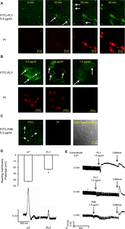 PLY binds to cardiomyocyte membrane and disrupts Ca2+ homeostasis and membrane potential at sub-lytic concentrations.