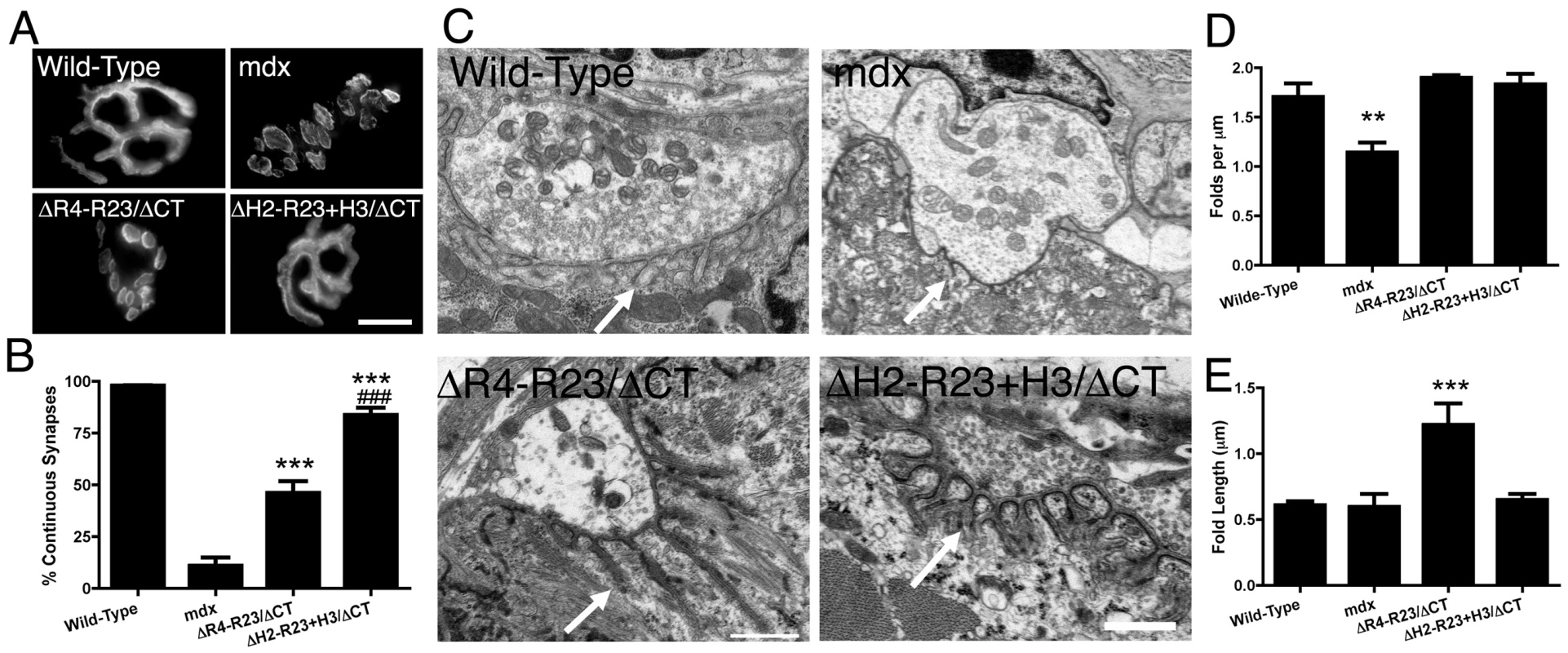The hinge domains of dystrophin influence the structure of neuromuscular synapses.