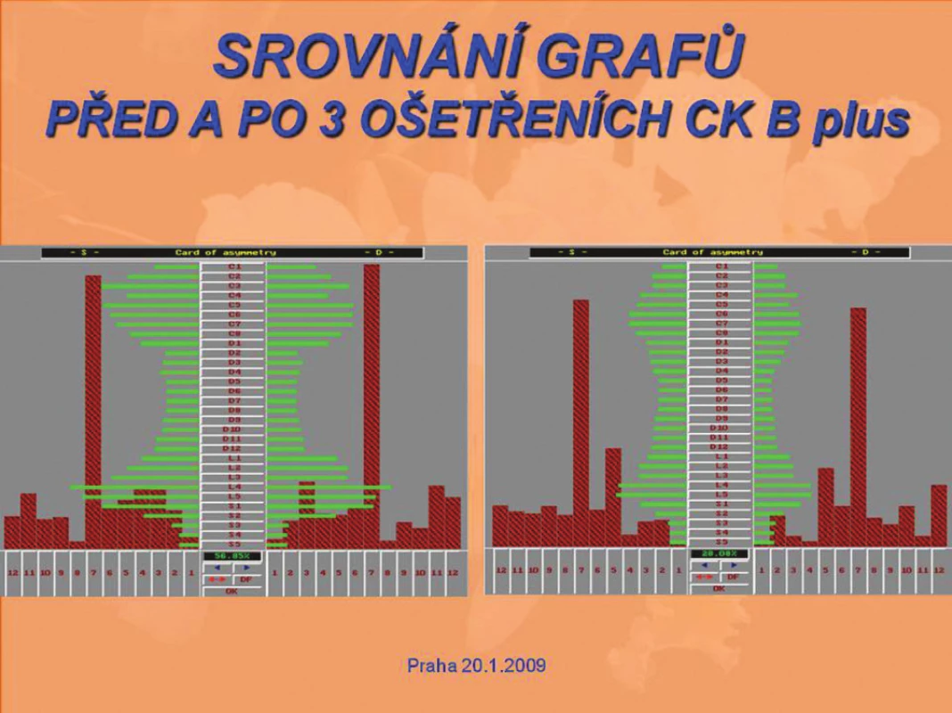 Srovnání grafů před a po 3 ošetřeních CK B plus.
