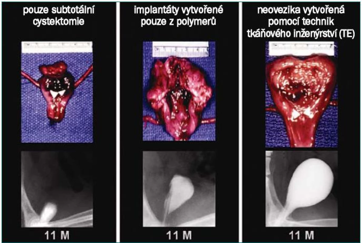 Makroskopické vzorky a cystogramy 11 měsíců po cystektomii u kontrolních objektů (neosázená matrix) a objektů, které podstoupily nahrazení močového měchýře pomocí tkáně osázené buňkami. Močový měchýř u objektů po cystektomii měl kapacitu 22 % hodnoty naměřené před zákrokem a komplianci 10 % hodnoty naměřené před zákrokem. U kontrolní skupiny (neosázená matrix) bylo zjištěno signifikantní zjizvení, kapacita 46 % hodnoty naměřené před zákrokem a kompliance 42 % hodnoty naměřené před zákrokem. U objektů, které podstoupily nahrazení močového měchýře s užitím tkáně osázené buňkami, byla zjištěna průměrná kapacita 95 % původního objemu (před cystektomií) a kompliance byla téměř srovnatelná s hodnotou naměřenou před zákrokem (s původním močovým měchýřem) – 106 %.