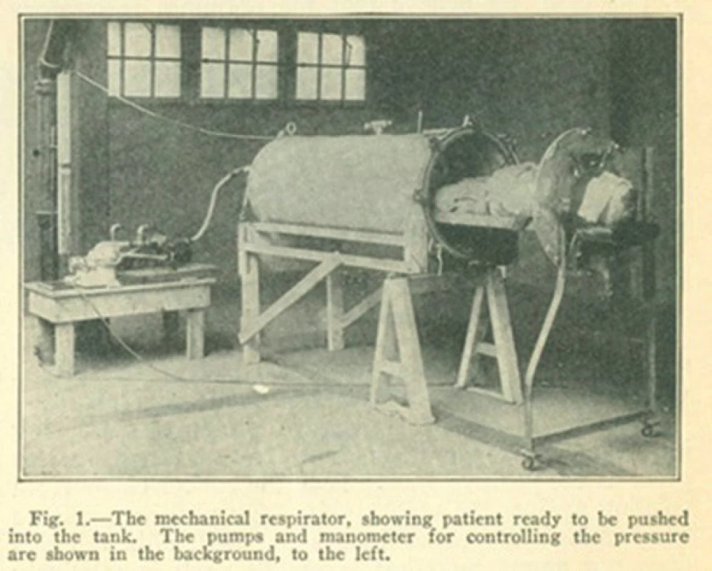 Ventilace negativním tlakem – “ocelové plíce“
Fig. 1: Negative pressure ventilator – “iron lung“