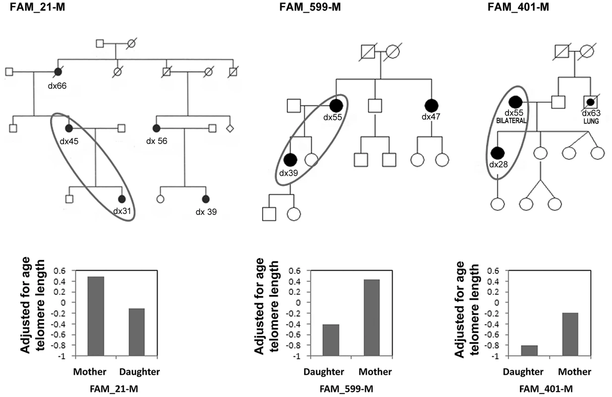 Familial breast cancer pedigrees showing anticipation in the age of onset of breast cancer.