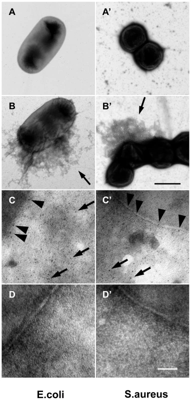 F XIII crosslinks are detectable on bacterial surfaces.