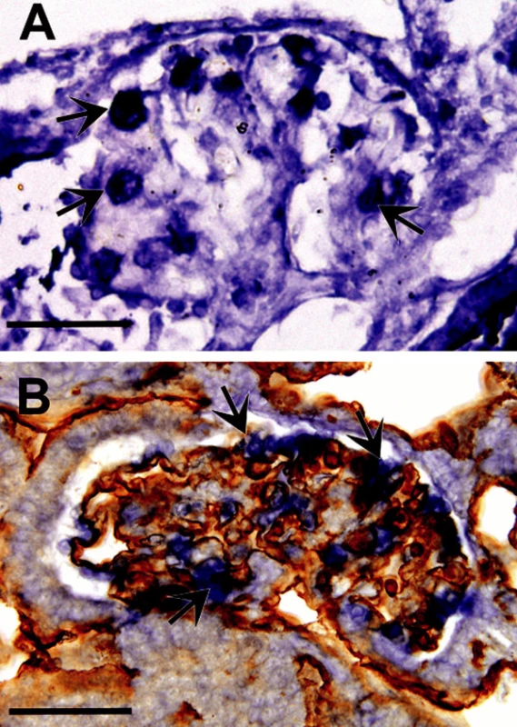A. Znázornění tkáňové hypoxie pomocí Hypoxyprobe na řezu glomerulem v mesonefros japonské křepelky 6. embryonální den. Třetí až šestý den byla koncentrace 02 snížena na 16 %. Modře jsou zbarveny okrsky tkáně s nižším parciálním tlakem kyslíku než 1,3 kPa přičemž intenzita zbarvení stoupá se stupněm hypoxie. Nejvyšší míru hypoxie vykazují podocyty (šipky); měřítko – 50 μm.
B. Srovnatelný řez z embrya jako na obrázku A zpracovaný ke znázornění mRNA pro VEGF-A (modře) technikou in situ hybridizace a dobarvený protilátkou QH1 ke znázornění endotelu (hnědě). Podocyty (šipky) jsou největším zdrojem VEGF-A, který stimuluje tvorbu kapilárních kliček glomerulu; měřítko – 50 μm.